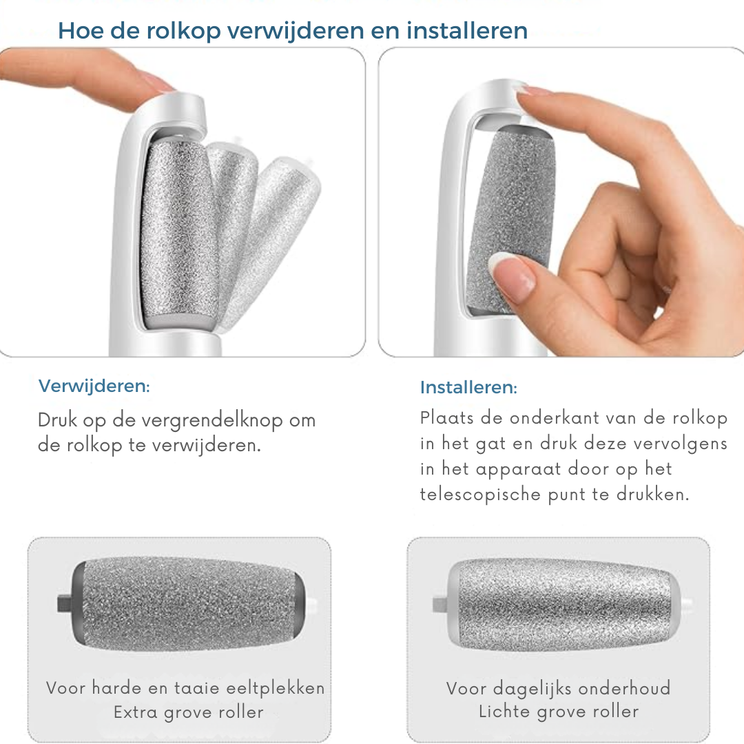 Elektrische Eeltverwijderaar – Voor Zachte Voeten Zonder Gedoe