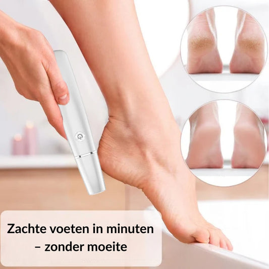 Elektrische Eeltverwijderaar – Voor Zachte Voeten Zonder Gedoe