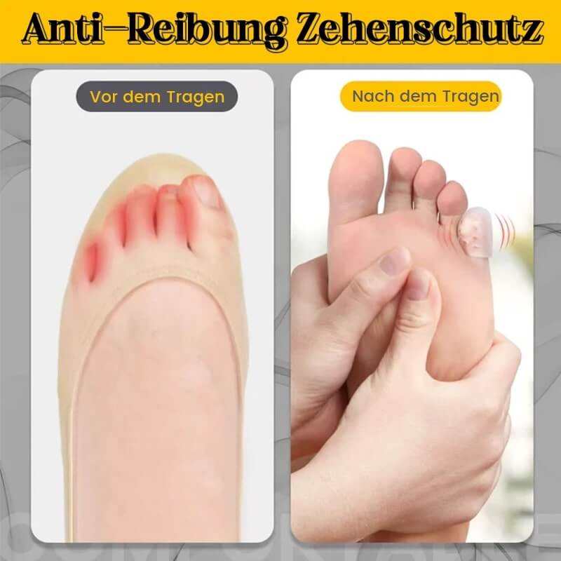 2+2 Gratis ToeTube™ Silicone Antifrictie Toe Beschermer