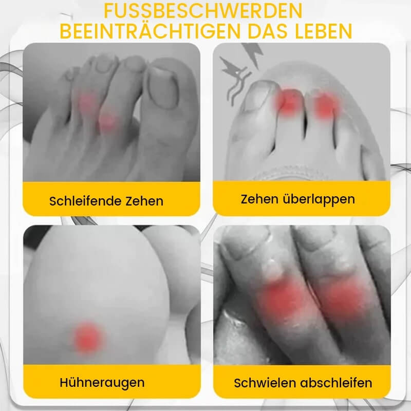 2+2 Gratis ToeTube™ Silicone Antifrictie Toe Beschermer