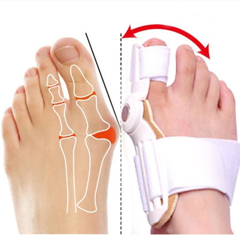 Bunion Corrector Spalk - Lozenza